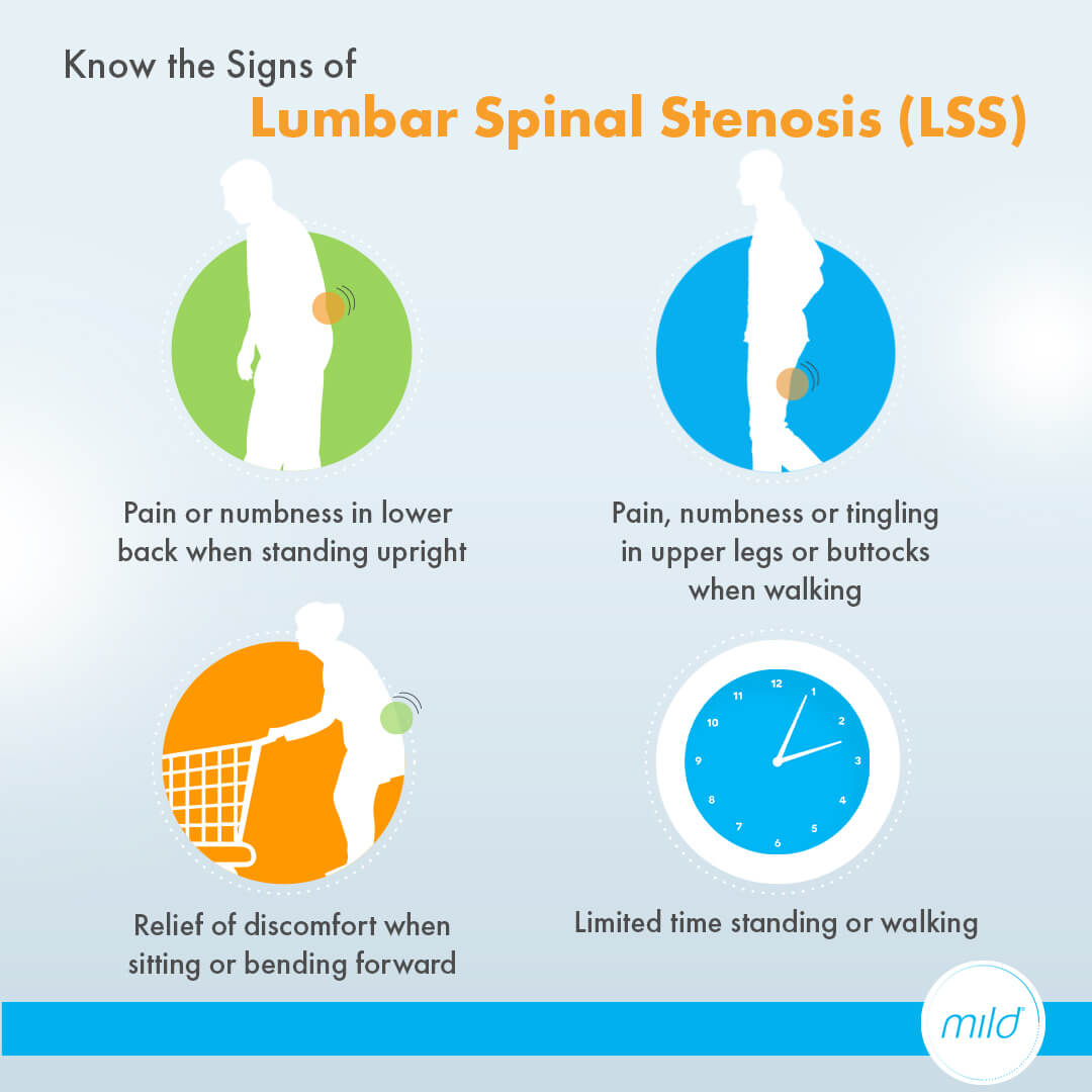 Signs of Lumbar Spinal Stenosis