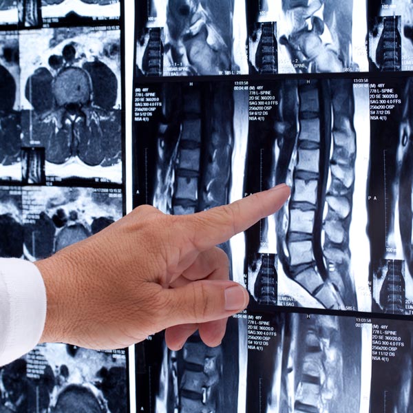 Pain Management Treatments in Pearland, TX