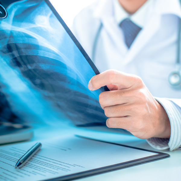 Chest X-ray showing bones and organs at Texas Institute of Pain & Spine in Pearland, TX.