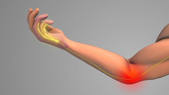 Therapeutic nerve block injection blocked pain in a hand in Pearland, Texas